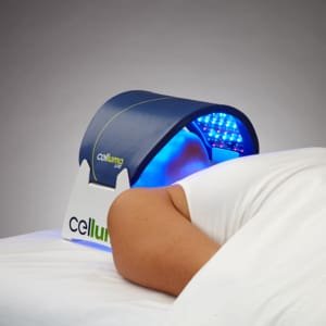 blue light therapy device for acne